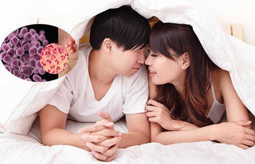 phòng ngừa herpes sinh dục (HSV)