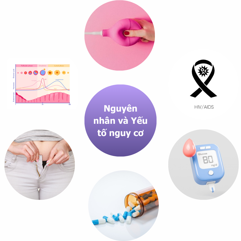 nguyên nhân và yếu tố nguy cơ gây ra viêm âm đạo, nhiễm nấm candida
