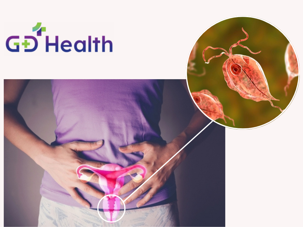 Trichomoniasis: Symptoms, Consequences, Complications, and Diagnosis