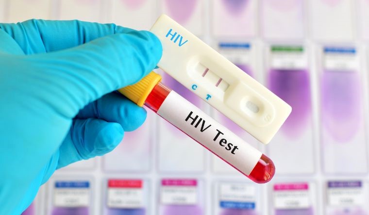 Tự xét nghiệm HIV tại nhà trước khi dùng PEP: Có nên không?