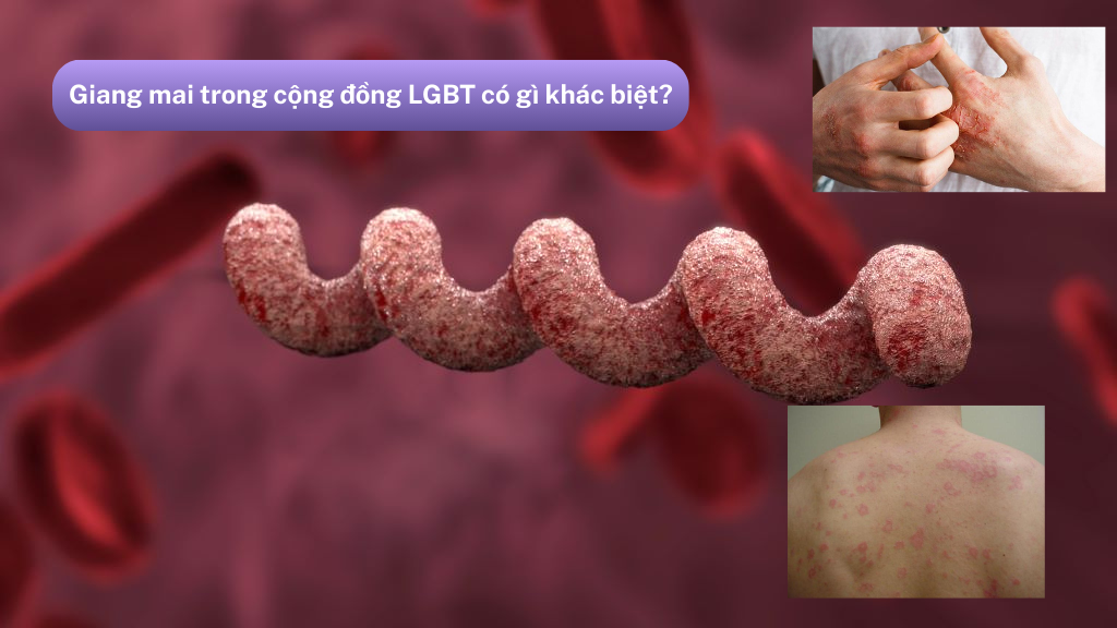 Giang mai trong cộng đồng LGBT có gì khác biệt?