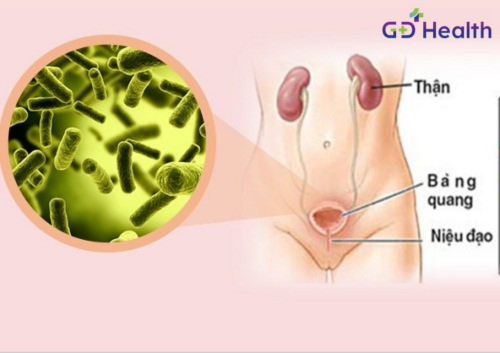Nhiễm khuẩn đường tiết niệu (Urinary Tract Infection-UTI)
