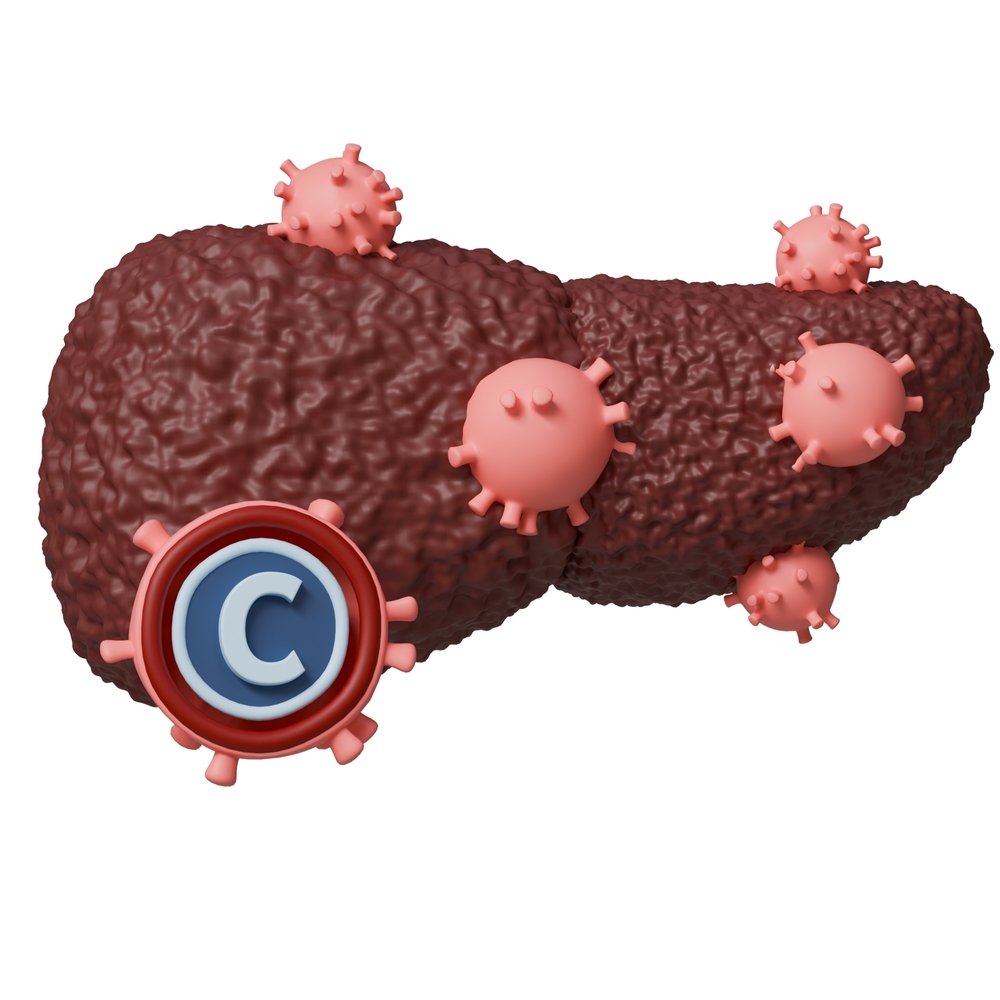 Bệnh viêm gan C: Đừng lơ là!