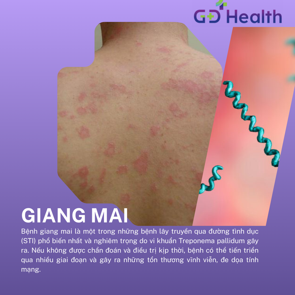 Bệnh giang mai